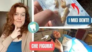 Tolgo TUTTI I DENTI DEL GIUDIZIO, vi porto con me!