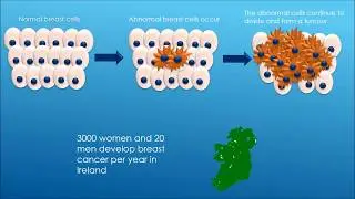 Tell It Straight 2018: Nicola Gaynor-Breast Cancer Immune Response