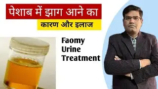 Foamy Urine - Causes Test and Treatment (in Hindi) पेशाब में झाग का इलाज