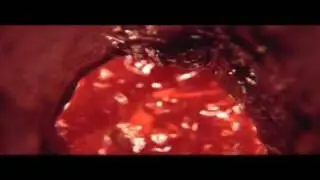 Береги себя.  Поджелудочная железа.avi