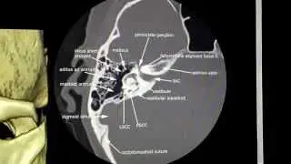 Facial Nerve Segments