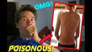 STUNG BY A POISONOUS CORAL!! | Vlog #2