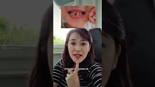 Anak usia 8 tahun, tapi gigi susu belum ada yg lepas sama sekali. #tanyamindok #kidzdentaleducation
