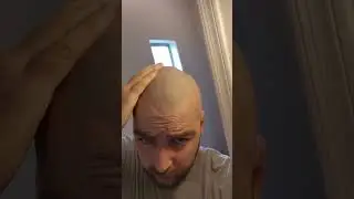 NO oil, still SHINY! #ZEROSHINE smp on bald head Mattifying the shine.