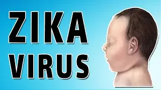 Zika Virus and Pregnancy