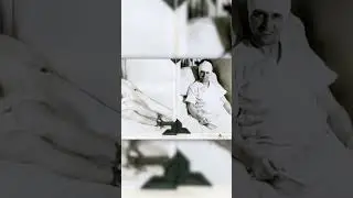 Лоботомия в СССР Часть 2 