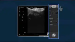 4  como hacer una ecografía con mediexpert