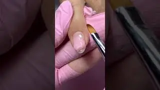 Как исправить клюющий ноготь?