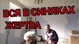 МАМА - Жертва. Прелетел от сына сильный удар , я вся в синяках.