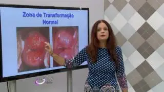 FERIDA NO COLO DO ÚTERO - PARTE 1