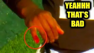 Shedeur Sanders Finger BLEEDING & Nose Injury | Buffalo Bills v Cleveland Browns 2025 NFL Highlights