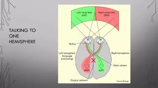 10 Hemispheric Specialization Pt 1