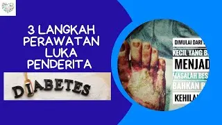 3 Langkah perawatan luka penderita Diabetes