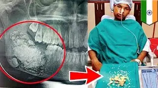 5 ШОКИРУЮЩИХ ФАКТОВ О ЗУБАХ
