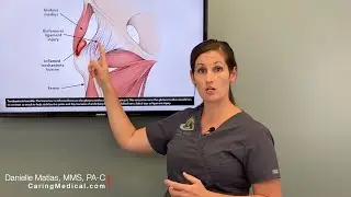 Treating Hip Bursitis - Regenerative options when traditional treatments stop working