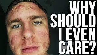 WATCH THIS IF ACNE MAKES YOU FEEL TERRIBLE...