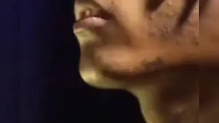 XXXTENTATCION $$$ | xxxtentatcion whatsapp status
