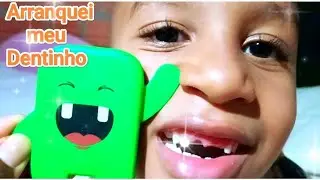 TIREI O DENTE DE LEITE/I had my milk tooth extracted/Me saqué el iente de leche  PARA FADA DO DENTE.
