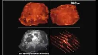 Innovations in Imaging (Dance of Cells)