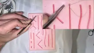 Subcuticular running suture & Aberdeen knot