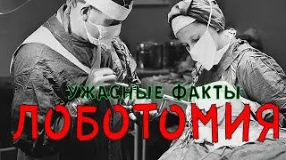 Лоботомия ужасные факты.