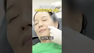 ep90.동안 미인 만드는 나비존리프팅 시술!#shorts
