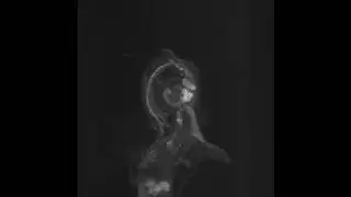 3D image of autofluorescent mouse cochlea