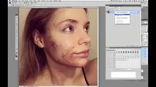 Photoshop Tutorial for Beginners - Photoshop how to remove pimples