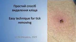 Як просто і легко видалити кліща