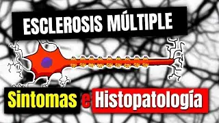 Esclerosis múltiple SINTOMAS E HISTOPATOLOGÍA  || P2