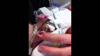 Kangaroo care