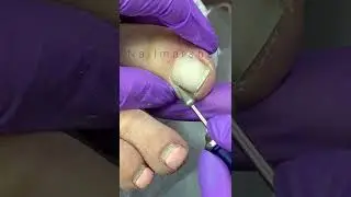 Педикюр с пенкой Pink Royss 
