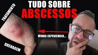 O Que É ABSCESSO? *minha experiencia* Drenagem... Tratamento