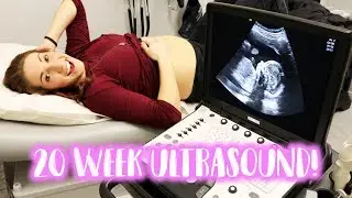 20 Week Pregnancy Anatomy Scan - 4D Ultrasound!
