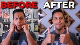 Reduce Room Echo Without UGLY Panels | Arrowzoom Review