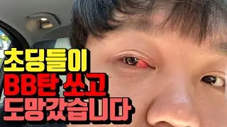 길가는 초딩들이 쏜 비비탄총에 눈을 맞았습니다 초딩들찾습니다