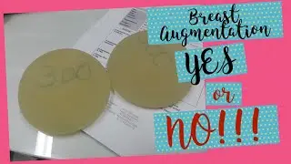 Implan Payudara yes or no? Masih bisa menyusui ga setelah implan payudara - before and after Implant