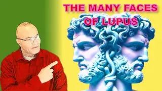 What Symptoms Diagnose Lupus?