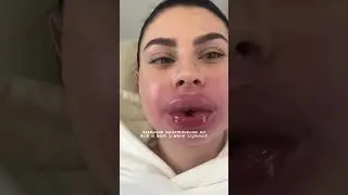 Вот так вот 🫢