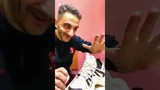 после чистки кроссовок появилось жёлтые пятна. Как убрать жёлтые пятна от белых кроссовок.