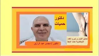 تحليل الإيدز و تورم الغدد الليمفاوية تحت الإبط | HIV test