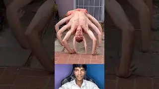 man is 8 leg😱💯🤯#shorts