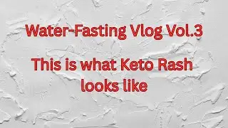 Water Fasting Vlog No.3  This is what Keto Rash looks like