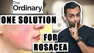 You Should Try These Products | Rosacea Relief