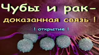 Чубы и рак - доказанная связь !