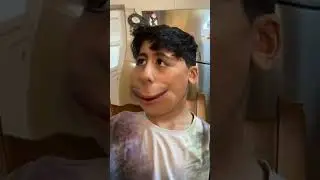 مڵچە مڵچ 😡
