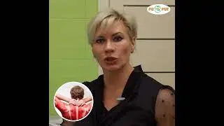 После Ковид болят мышцы - что делать