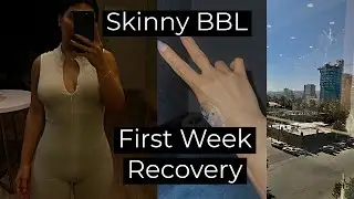 I got a SKINNY BBL in Mexico