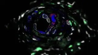 JID February 2024 Cover: SARS-CoV-2 from Skin Lesion to Ultrastructure