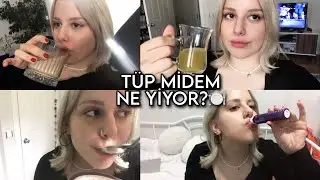 Tüp Mideyle Bir Günde Neler Yiyorum? 🍽 | Güncelleme & Sohbet